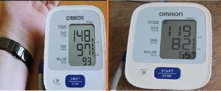 Tachometer readings before and after taking Cardione